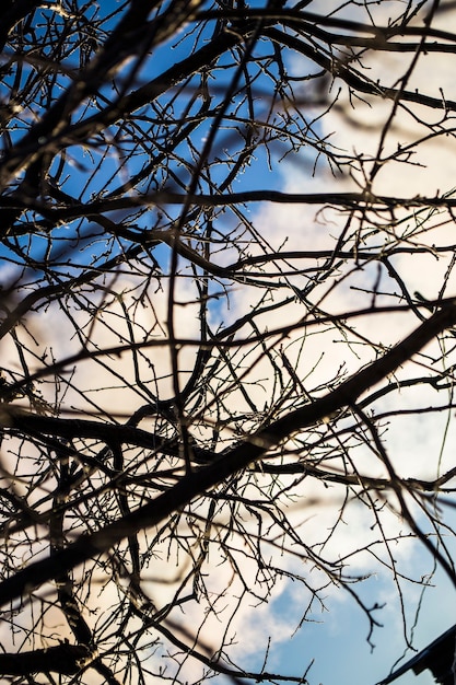 Bare winter tree branches against a blue sky