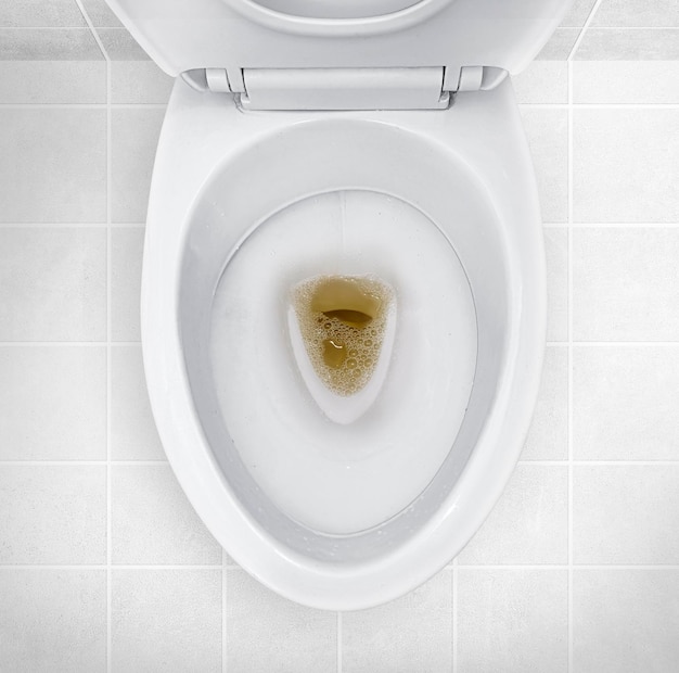 Photo bathroom toilet with dark colored urine