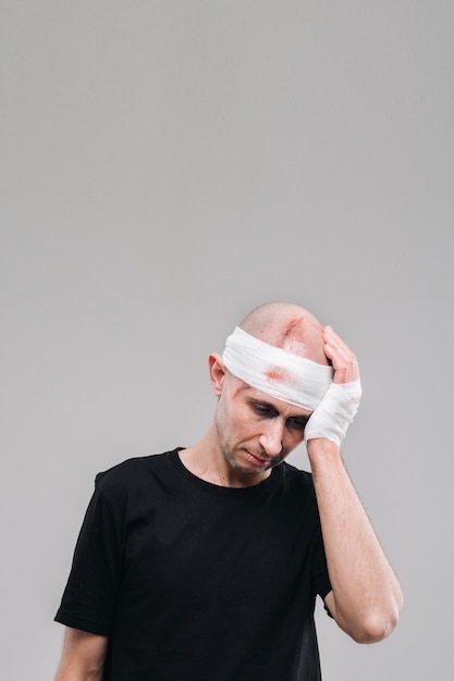 A battered and battered man in a black T-shirt stands against a gray background, holding his aching head with his hands wrapped around it.