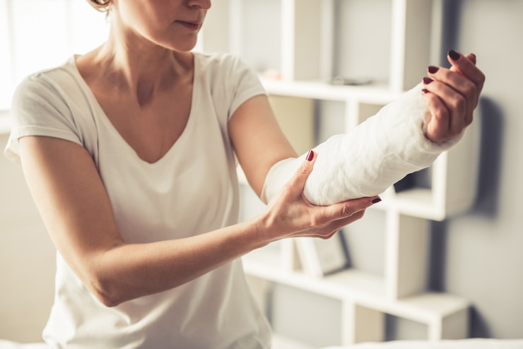 Photo bautiful mature woman with her arm in gypsum.