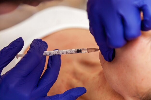 A beautician in blue gloves makes beauty injection