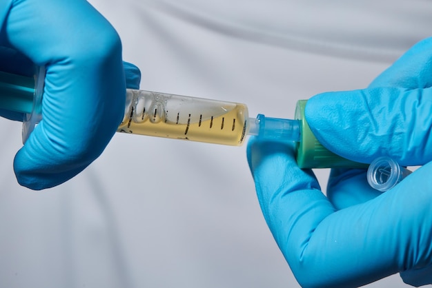 Beautician doctor's hands put test tube with blood in centrifuge container Rejuvenation plasmolifting procedure