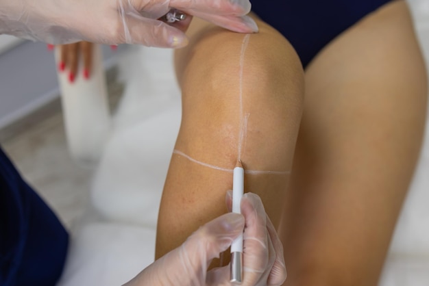 Beautician Giving Epilation Laser Treatment To Woman On Thigh.