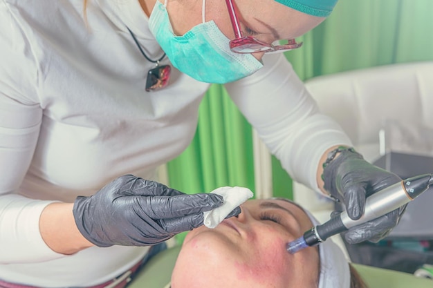 Foto l'estetista esegue un trattamento di mesoterapia con ago sul viso di una donna