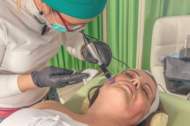 미용사는 여성의 얼굴에 바늘 메조테라피 치료를 합니다.