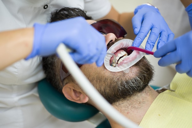 Beautiful european man smile with healthy teeth whitening. Close up of men patient with beard with open mouth sitting in medical chair and doctor with assistant making teeth check up in dental clinic.