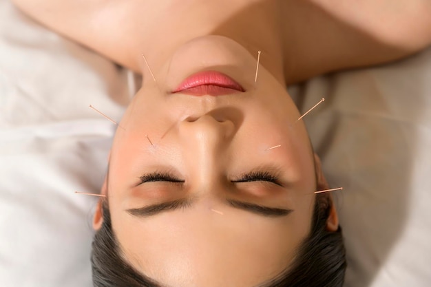 Beautiful Woman Received acupuncture treatment on face by therapist chinese medicine