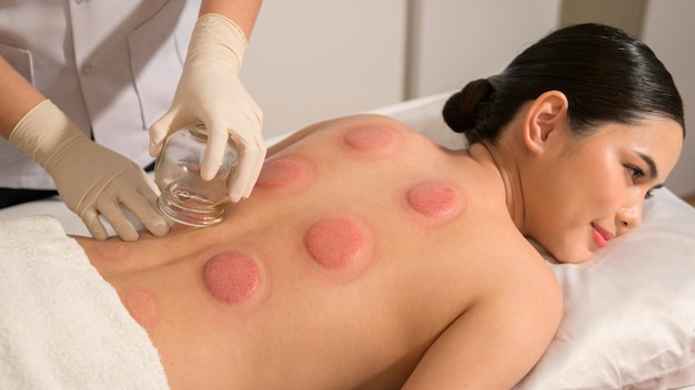 Beautiful Woman Received cupping treatment on back by therapist chinese