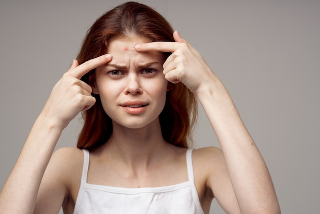 Beautiful woman in a white tshirt pimples on the face isolated\
background