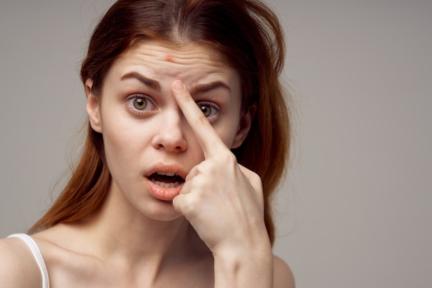 Beautiful woman in a white tshirt pimples on the face light\
background