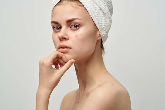 Beautiful woman with a pimple on the face cosmetology studio.\
high quality photo