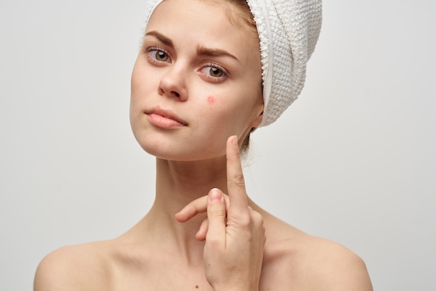 Beautiful woman with a pimple on the face cosmetology\
studio