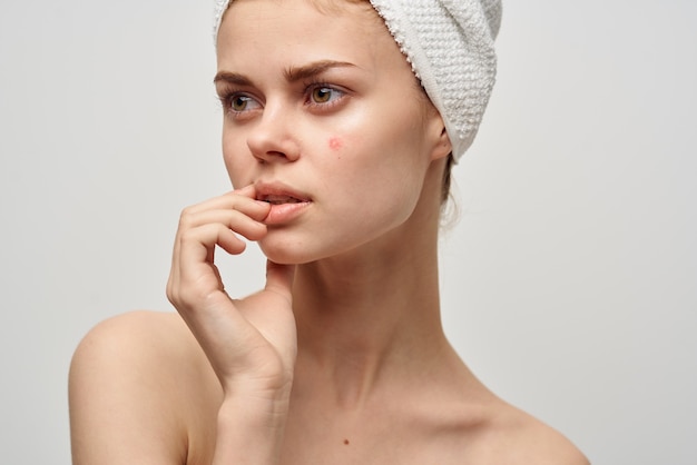 Beautiful woman with a pimple on the face cosmetology\
studio