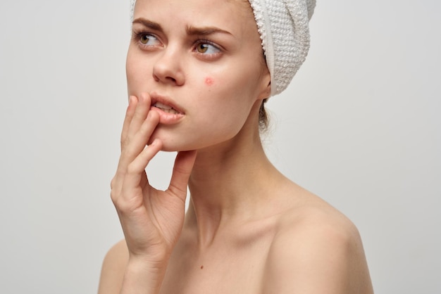 Beautiful woman with a pimple on the face dermatology isolated\
background