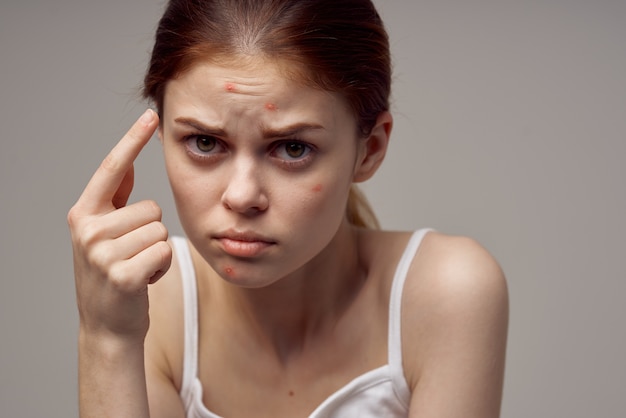 Beautiful woman with pimples on the face hygiene isolated\
background