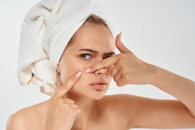 Beautiful woman with a towel on my head facial skin problems\
light background