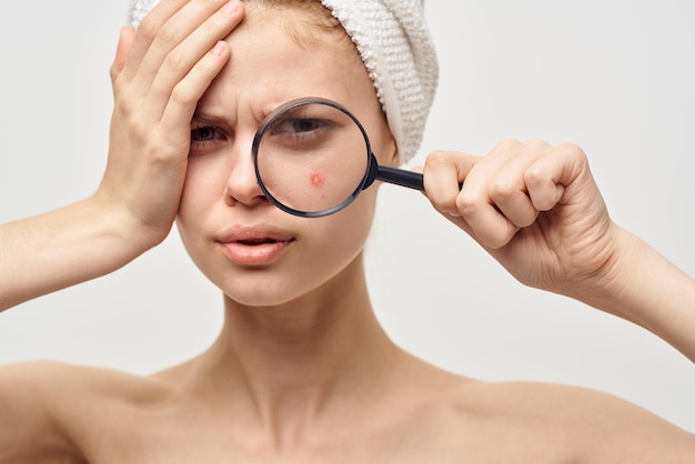 Beautiful woman with a towel on my head skin problems closeup