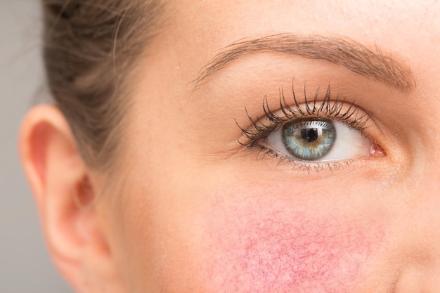 A beautiful young caucasian woman is seen upclose in macro detail focus on the healthy green eye