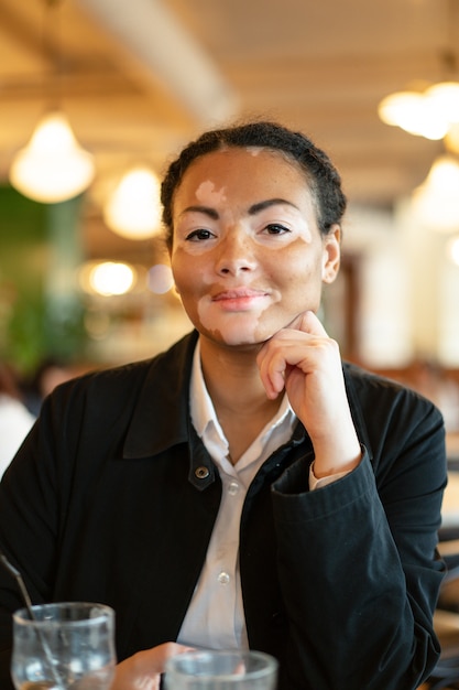 A beautiful young girl of African ethnicity with vitiligo sitting in a restaurant