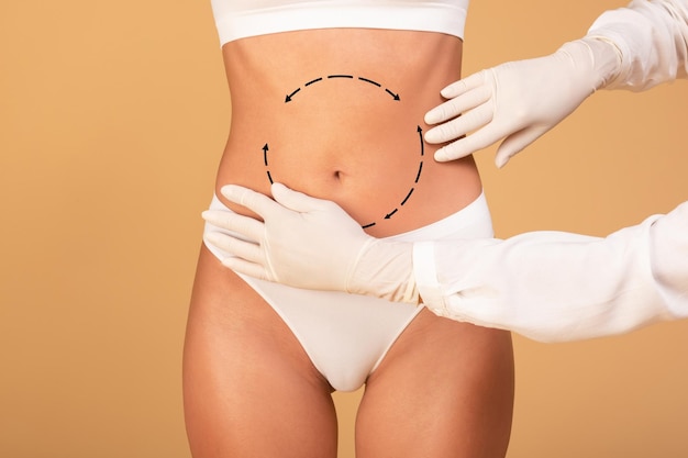 Photo beauty procedure for body slim lady having lipolysis treatment plastic surgeon making marks at female39s belly