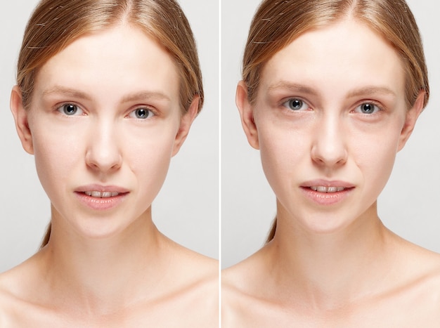 Photo before and after cosmetic operation