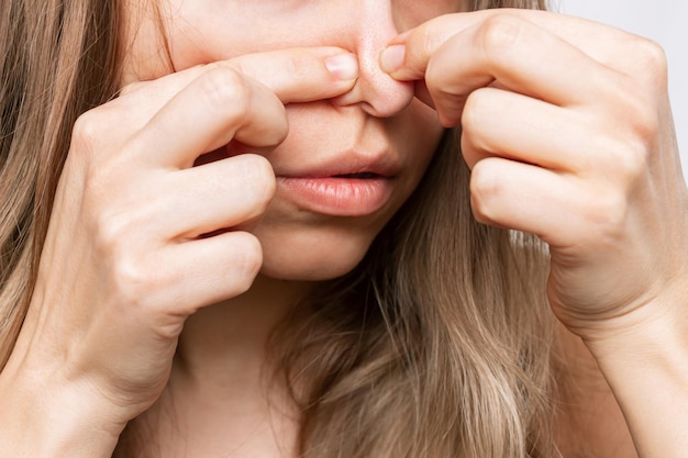 Bijgesneden opname van jonge vrouw die met haar vingers een zwarte kop of comedonen uitknijpt Acneprobleem