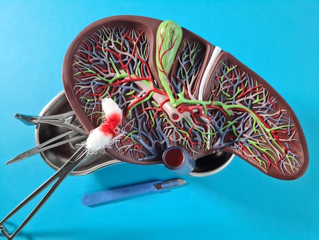 Photo biliary surgery of liver and gallbladder closeup