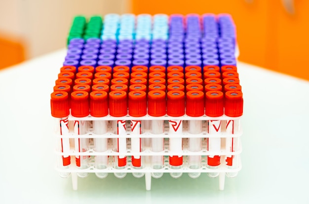 Biochemical scientific technologies. Medical blood test tubes for researching.