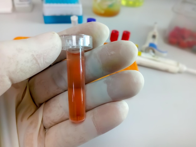 Il biochimico tiene un campione di liquido pleurico con background di laboratorio pronto per il test biochimico