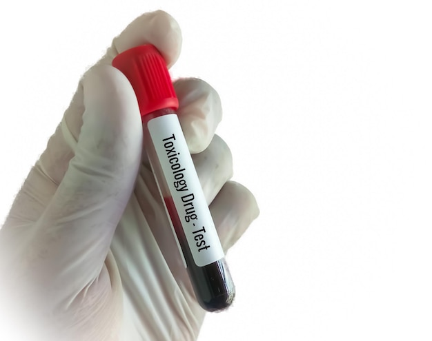 Biochemist holding blood sample with white background for Toxicology drug testing.