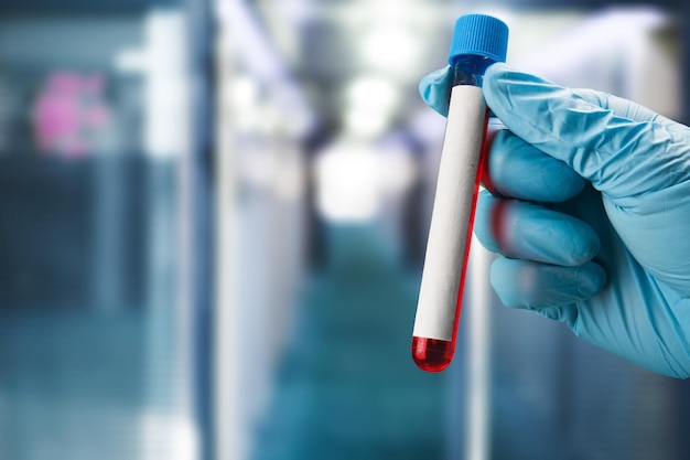 Biochemist or Lab Technologist hand holds Blood sample for test.