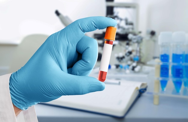 Biochemist or Lab Technologist holds Blood samples for tests with laboratory background.