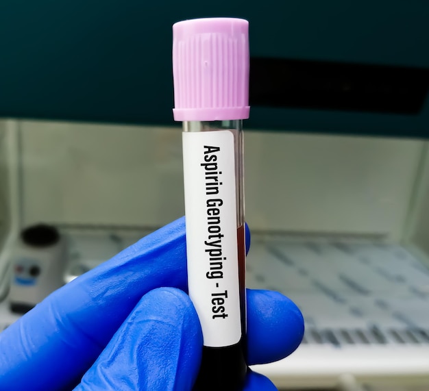 Biochemist or scientist hold blood sample for Aspirin Genotyping test in PCR laboratory.