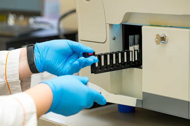 Biochemistry analysis pharmacy samples. laboratory medical test\
tubes.