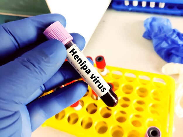 Biologisch monster bloed in een vacuümbuis voor pathologische analyse Medische laboratoriumtests