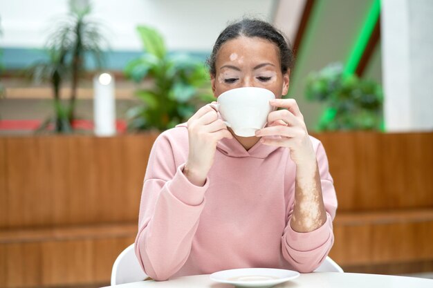 Photo black african american woman with vitiligo pigmentation skin problem indoor dressed pink hoodie