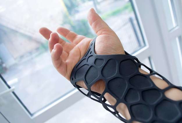 Black orthopedic plastic prosthesis printed on powder d printer on hand