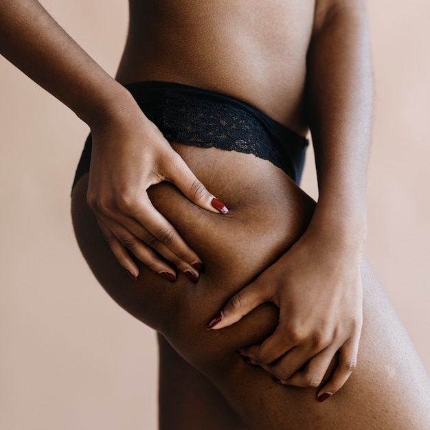 Photo black woman with a leg skin problem social template