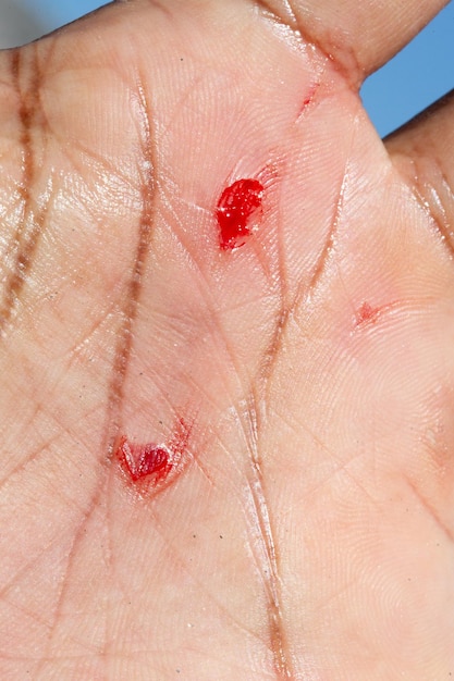Premium Photo | Bleeding wound on a man's hand following an accident macro  of cuts on human skin with blood loss work accidents concept