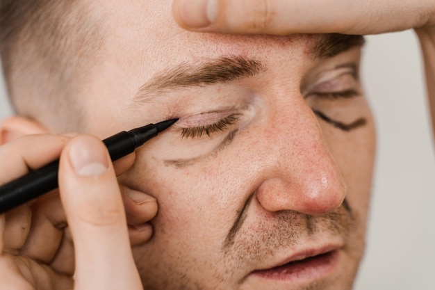 Blepharoplasty for man markup on the face before plastic surgery operation for modifying the eye region in medical clinic