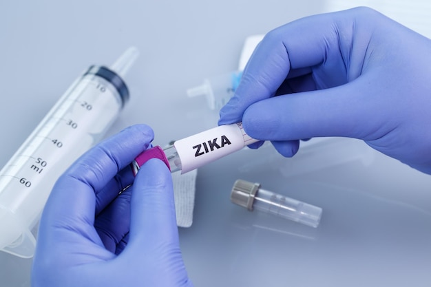 Bloedafnamebuizen met labels zika-virus