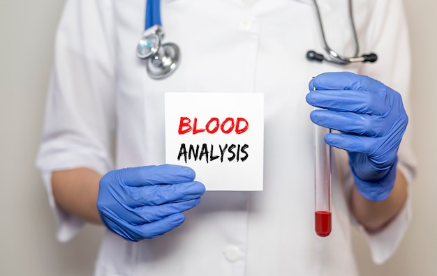 Bloedanalyse inscriptie op papier in handen van vrouwelijke arts met reageerbuis in handen.