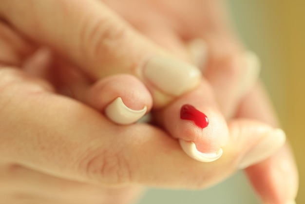 Bloeddaling op de vrouwelijke handen van de vingerclose-up van de vrouw met één bloedend vingerbloedonderzoekconcept