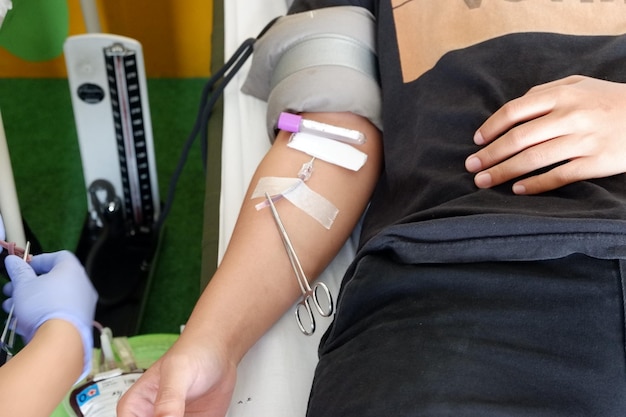 Bloeddonatie met een naald in de arm Concept afbeelding voor wereldbloeddonor