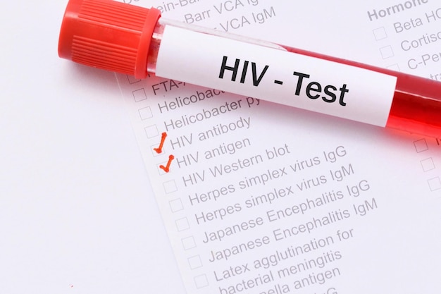 Foto bloedmonster voor hiv-test