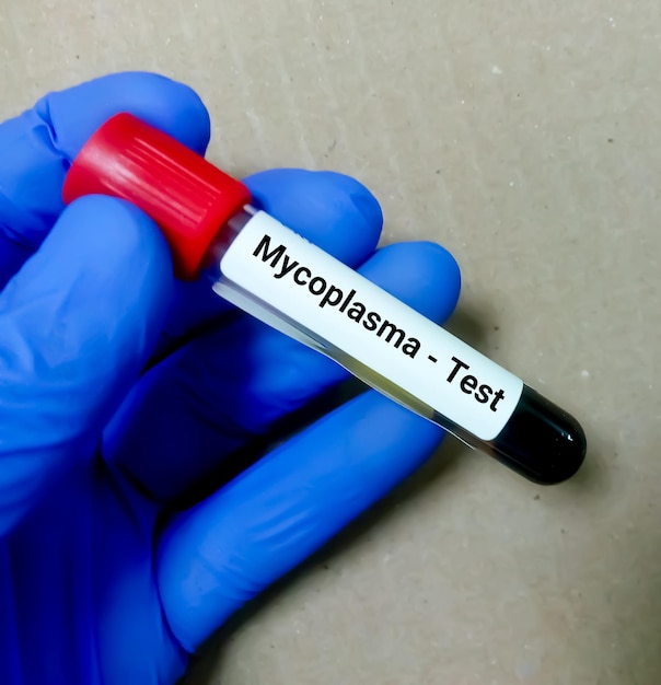 Bloedmonster voor Mycoplasma-testen