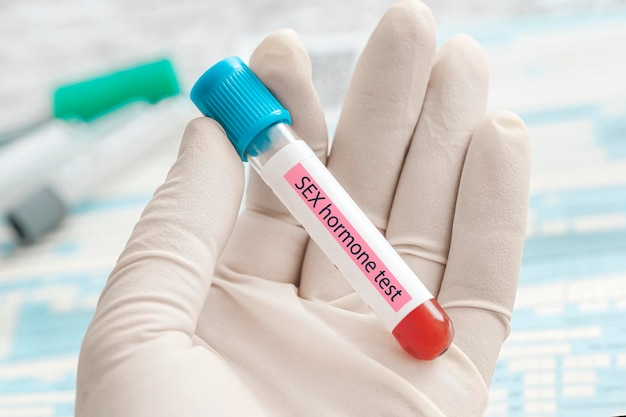 Bloedmonster voor studie van niveaus van geslachtshormonen test arts die bloedbuis vasthoudt voor analyse van hormonen in het laboratorium
