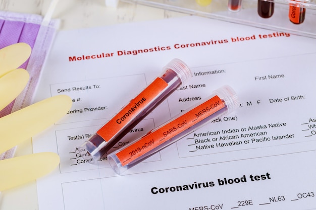 Bloedmonsters voor Coronavirus-test