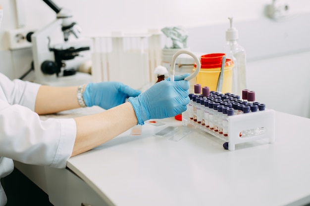 Bloedonderzoek in laboratorium. Artsenhanden die bloedonderzoek maken. Veel bloedonderzoek buizen met bloed op de tafel.