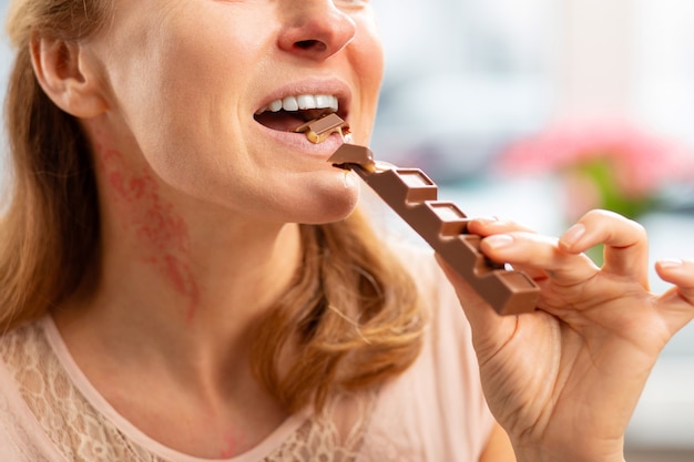 Blond haired mature woman with rash and reddening neck eating chocolate bar